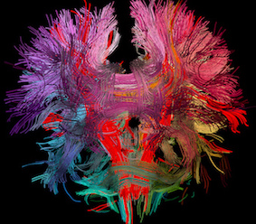 Neural connections in the human brain